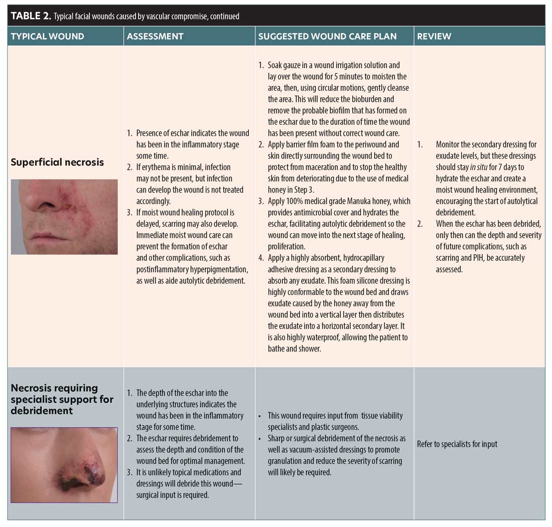 Facial Vascular Events and Tissue Ischemia: A Guide to Understanding ...