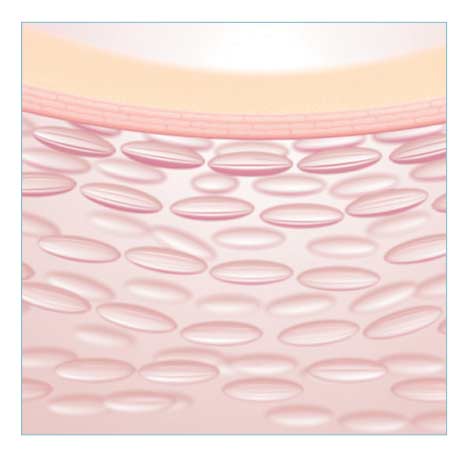 A Novel Facial Cream Based on Skin-penetrable Fibrillar Collagen Microparticles