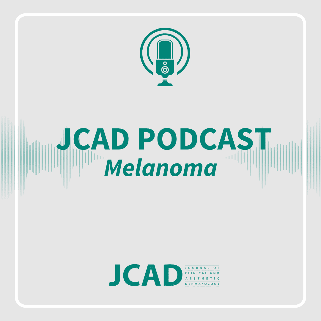 Melanoma