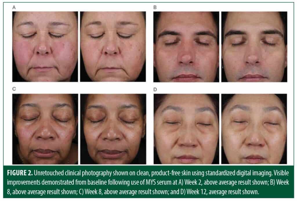 A Multi-center Trial Evaluating a Serum Comprised of Plant-based ...
